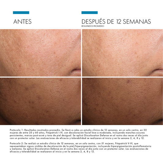 Skinceuticals Discoloration Defense - 30ml.