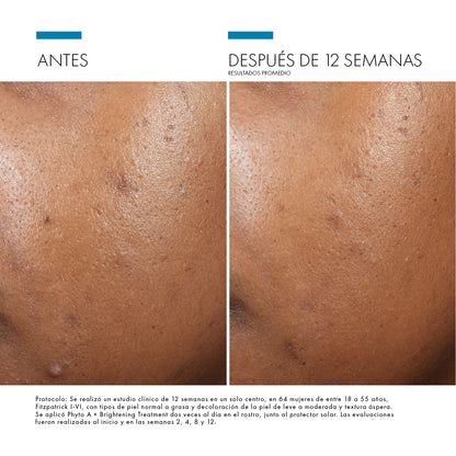 Skinceuticals Phyto A + Brightening Treatment - 30 ml.