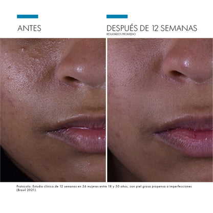 Skinceuticals Silymarin CF - 30ml.