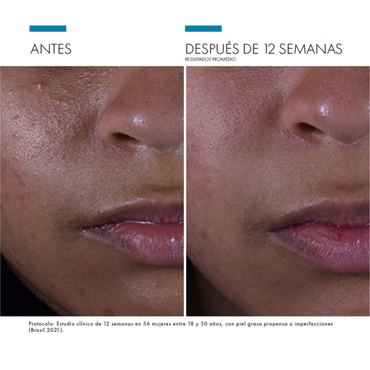 Skinceuticals Silymarin CF - 30ml.