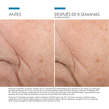 Skinceuticals Triple Lipid Restore - 48ml