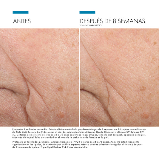 Skinceuticals Triple Lipid Restore - 48ml